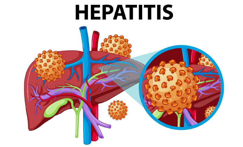 Ways to Prevent Hepatitis-E